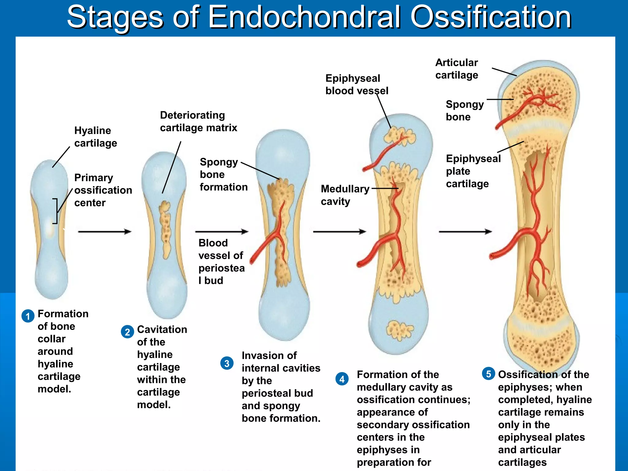 Formation
of bone
collar
around
hyaline
cartilage
model.
1
2
3
4
Cavitation
of the
hyaline
cartilage
within the
cartilage
model.
Invasion of
internal cavities
by the
periosteal bud
and spongy
bone formation.
5 Ossification of the
epiphyses; when
completed, hyaline
cartilage remains
only in the
epiphyseal plates
and articular
cartilages
Formation of the
medullary cavity as
ossification continues;
appearance of
secondary ossification
centers in the
epiphyses in
preparation for stage 5.
Hyaline
cartilage
Primary
ossification
center
Bone
collar
Deteriorating
cartilage matrix
Spongy
bone
formation
Blood
vessel of
periostea
l bud
Secondary
ossification
center
Epiphyseal
blood vessel
Medullary
cavity
Epiphyseal
plate
cartilage
Spongy
bone
Articular
cartilage
Stages of Endochondral OssificationStages of Endochondral Ossification
 