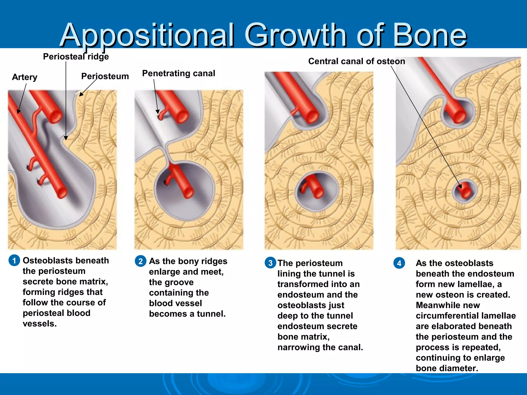 Osteoblasts beneath
the periosteum
secrete bone matrix,
forming ridges that
follow the course of
periosteal blood
vessels.
1 2 3 4As the bony ridges
enlarge and meet,
the groove
containing the
blood vessel
becomes a tunnel.
The periosteum
lining the tunnel is
transformed into an
endosteum and the
osteoblasts just
deep to the tunnel
endosteum secrete
bone matrix,
narrowing the canal.
As the osteoblasts
beneath the endosteum
form new lamellae, a
new osteon is created.
Meanwhile new
circumferential lamellae
are elaborated beneath
the periosteum and the
process is repeated,
continuing to enlarge
bone diameter.
Artery Periosteum Penetrating canal
Central canal of osteon
Periosteal ridge
Appositional Growth of BoneAppositional Growth of Bone
 