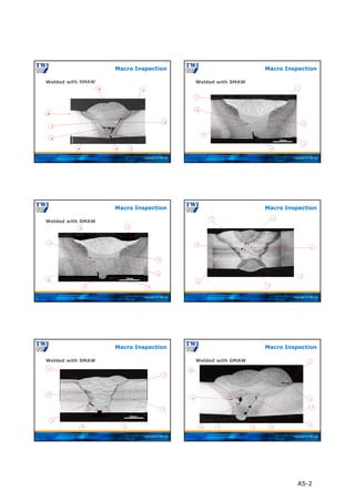 Copyright © TWI Ltd
Welded with SMAW
Macro Inspection
1
2
3
4
5
6
7
8
9
Copyright © TWI Ltd
1
7
6
5
2
3
4
Welded with SMAW
Macro Inspection
Copyright © TWI Ltd
Welded with SMAW
Macro Inspection
8 1
7
4
6
3
2
5
Copyright © TWI Ltd
Macro Inspection
1
6
4
3
2
5
7
Copyright © TWI Ltd
Welded with SMAW
Macro Inspection
7
6
5
4 3
1
2
Copyright © TWI Ltd
10
9
8 6 5
7
4
2
1
3
Welded with GMAW
Macro Inspection
A5-2
 