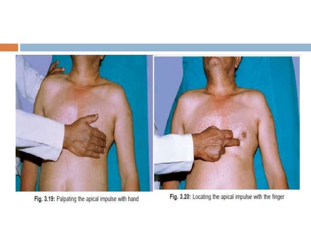 History And Examination In Pediatric Cvs