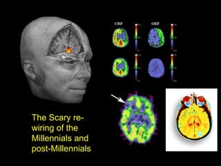 The Scary re-wiring of the Millennials and post-Millennials  