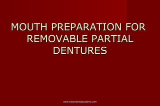MOUTH PREPARATION FOR
REMOVABLE PARTIAL
DENTURES

www.indiandentalacademy.com

 