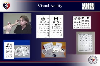 Visual Acuity
 