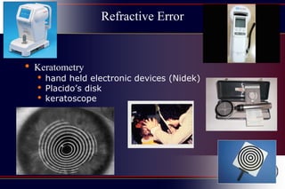 Refractive Error
• Keratometry
• hand held electronic devices (Nidek)
• Placido’s disk
• keratoscope
 