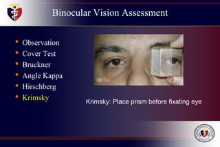 Binocular Vision Assessment
• Observation
• Cover Test
• Bruckner
• Angle Kappa
• Hirschberg
• Krimsky Krimsky: Place prism before fixating eye
 