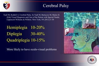 Cerebral Palsy
Taub M, Reddell A. Cerebral Palsy. In Taub M, Bartuccio M, Maino D.
(Eds) Visual Diagnosis and Care of the Patient with Special Needs;
Lippincott Williams & Wilkins. New York, NY;2012:21-30
Hemiplegia 10-20%
Diplegia 30-40%
Quadriplegia 10-15%
More likely to have oculo-visual problems
 