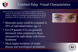 Cerebral Palsy Visual Characteristics
Wesson M, Maino D. Oculovisual findings in children with Down
syndrome, Cerebral Palsy, and mental retardation without specific
etiology. In Maino, D. (ed) Diagnosis and management of special
populations. 1995. St. Louis, Mo. , Mosby-Yearbook Inc.:17-54
.
• Binocular acuity could be evaluated in
45% of individuals below age 13
• For CP patients VAs are generally
decreased when compared to those
measured for individuals with Down
Syndrome
• Much higher incidence of ocular
disease and neurological dysfunction
 
