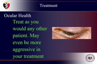 Treatment
Ocular Health
Treat as you
would any other
patient. May
even be more
aggressive in
your treatment
 