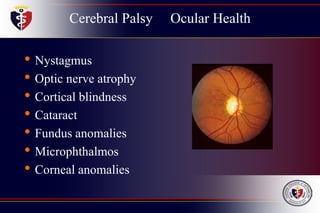 Cerebral Palsy Ocular Health
• Nystagmus
• Optic nerve atrophy
• Cortical blindness
• Cataract
• Fundus anomalies
• Microphthalmos
• Corneal anomalies
 