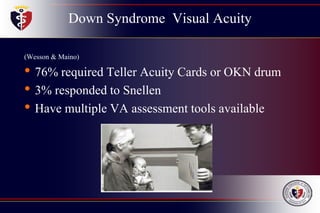 Down Syndrome Visual Acuity
(Wesson & Maino)
• 76% required Teller Acuity Cards or OKN drum
• 3% responded to Snellen
• Have multiple VA assessment tools available
 