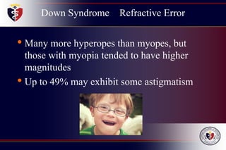 Down Syndrome Refractive Error
• Many more hyperopes than myopes, but
those with myopia tended to have higher
magnitudes
• Up to 49% may exhibit some astigmatism
 