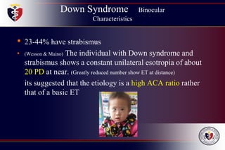 Down Syndrome Binocular
Characteristics
• 23-44% have strabismus
• (Wesson & Maino) The individual with Down syndrome and
strabismus shows a constant unilateral esotropia of about
20 PD at near. (Greatly reduced number show ET at distance)
its suggested that the etiology is a high ACA ratio rather
that of a basic ET
 