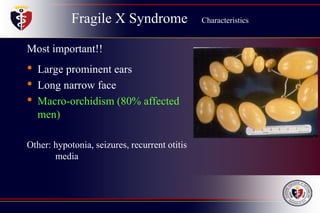 Fragile X Syndrome Characteristics
Most important!!
• Large prominent ears
• Long narrow face
• Macro-orchidism (80% affected
men)
Other: hypotonia, seizures, recurrent otitis
media
 