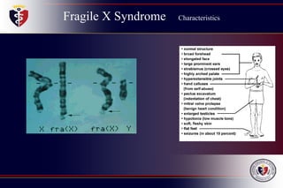 Fragile X Syndrome Characteristics
 