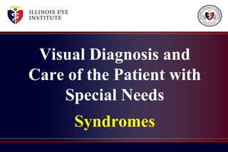Visual Diagnosis and
Care of the Patient with
Special Needs
Syndromes
 