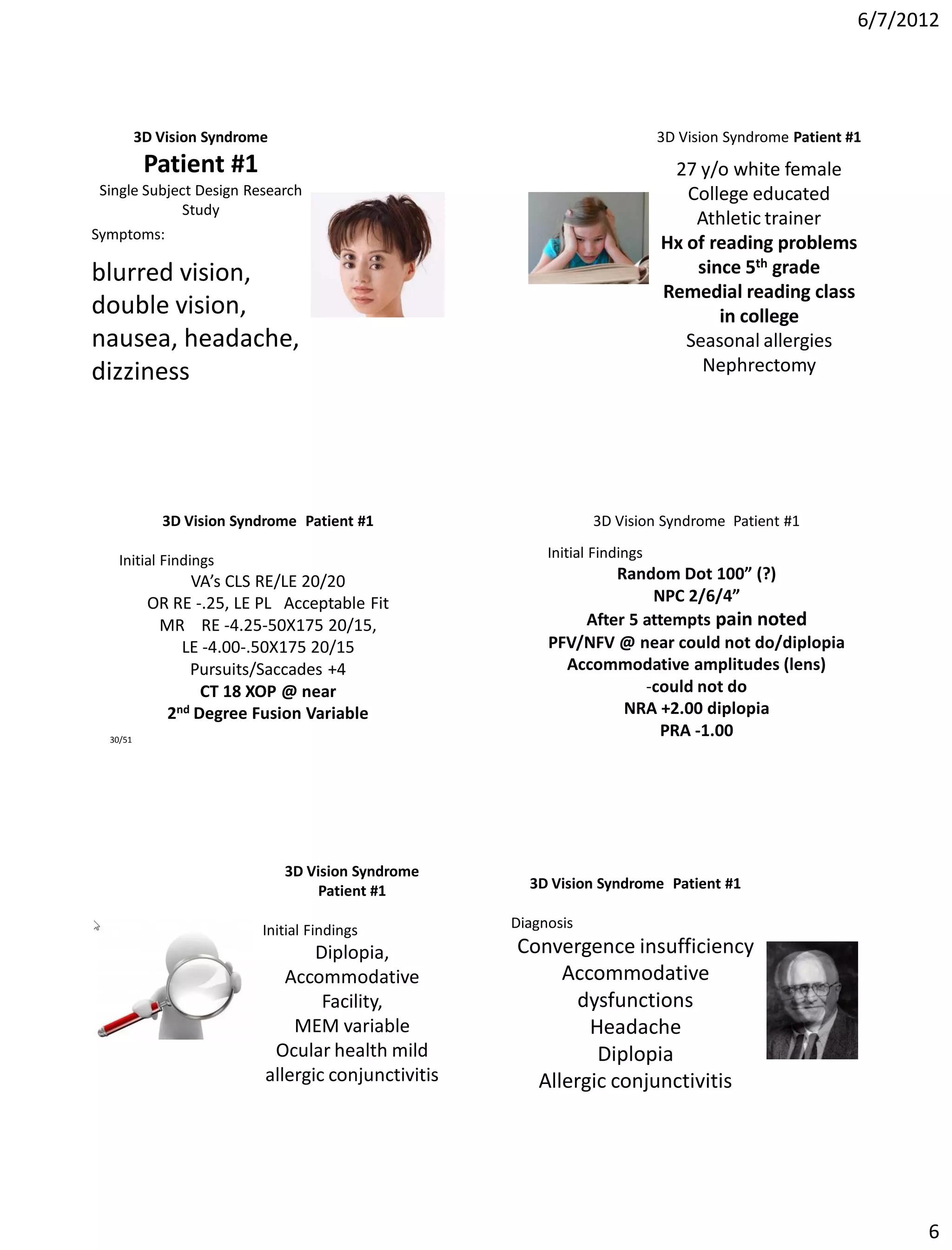 6/7/2012




          3D Vision Syndrome                                                 3D Vision Syndrome Patient #1
           Patient #1                                                         27 y/o white female
Single Subject Design Research                                                  College educated
            Study
                                                                                 Athletic trainer
Symptoms:
                                                                             Hx of reading problems
blurred vision,                                                                  since 5th grade
                                                                             Remedial reading class
double vision,                                                                      in college
nausea, headache,                                                               Seasonal allergies
dizziness                                                                         Nephrectomy




             3D Vision Syndrome Patient #1                       3D Vision Syndrome Patient #1

    Initial Findings                                      Initial Findings
                VA’s CLS RE/LE 20/20                              Random Dot 100” (?)
           OR RE -.25, LE PL Acceptable Fit                            NPC 2/6/4”
            MR RE -4.25-50X175 20/15,                         After 5 attempts pain noted
               LE -4.00-.50X175 20/15                     PFV/NFV @ near could not do/diplopia
                Pursuits/Saccades +4                        Accommodative amplitudes (lens)
                  CT 18 XOP @ near                                    -could not do
             2nd Degree Fusion Variable                            NRA +2.00 diplopia
  30/51
                                                                        PRA -1.00




                               3D Vision Syndrome
                                    Patient #1         3D Vision Syndrome Patient #1

                           Initial Findings          Diagnosis
                                  Diplopia,          Convergence insufficiency
                              Accommodative               Accommodative
                                   Facility,                dysfunctions
                               MEM variable                  Headache
                            Ocular health mild                Diplopia
                           allergic conjunctivitis     Allergic conjunctivitis




                                                                                                               6
 