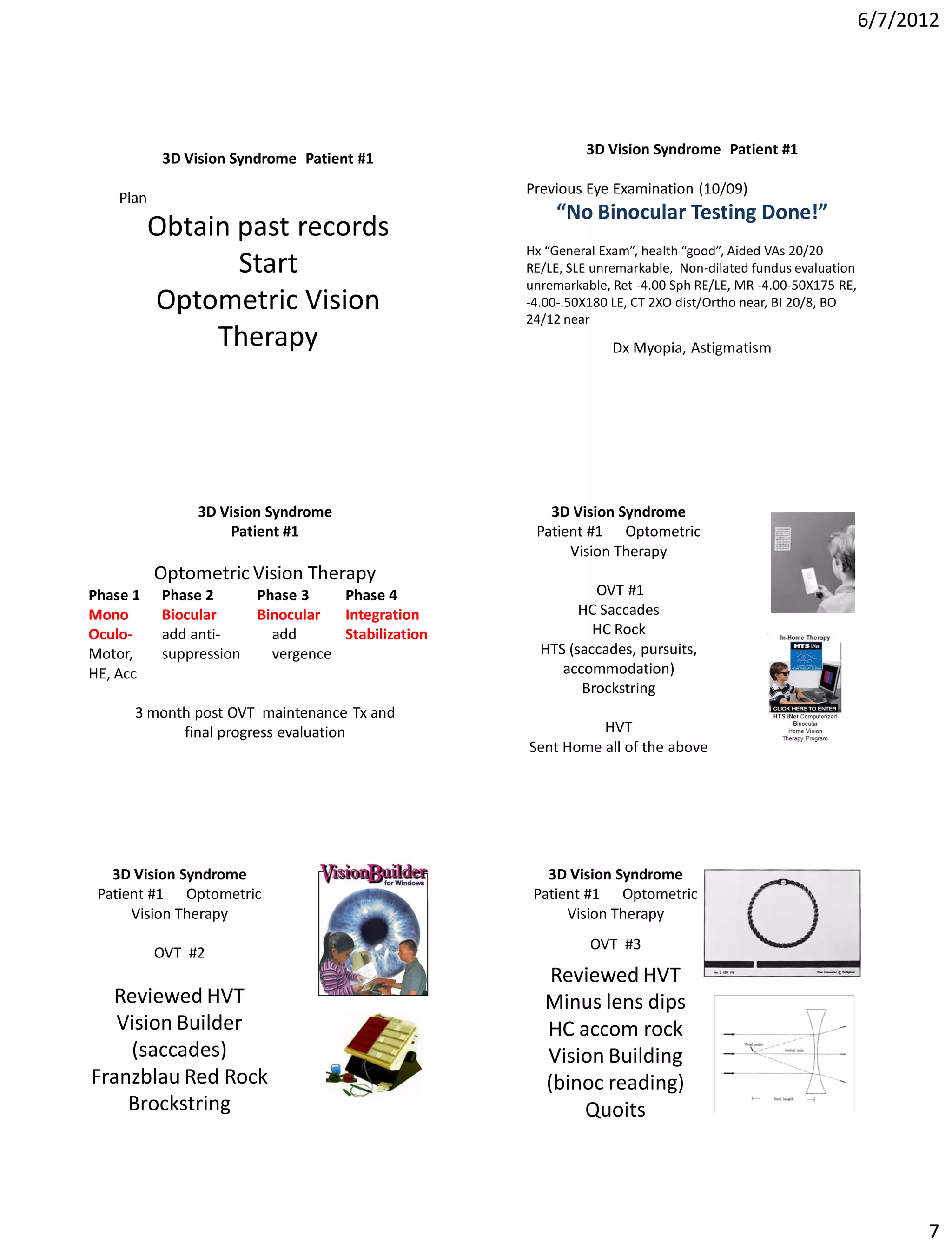 6/7/2012




                                                              3D Vision Syndrome Patient #1
            3D Vision Syndrome Patient #1
                                                     Previous Eye Examination (10/09)
    Plan
                                                         “No Binocular Testing Done!”
           Obtain past records
                                                     Hx “General Exam”, health “good”, Aided VAs 20/20
                  Start                              RE/LE, SLE unremarkable, Non-dilated fundus evaluation
                                                     unremarkable, Ret -4.00 Sph RE/LE, MR -4.00-50X175 RE,
           Optometric Vision                         -4.00-.50X180 LE, CT 2XO dist/Ortho near, BI 20/8, BO
                                                     24/12 near
                Therapy                                            Dx Myopia, Astigmatism




                 3D Vision Syndrome                     3D Vision Syndrome
                     Patient #1                       Patient #1 Optometric
                                                           Vision Therapy
           Optometric Vision Therapy
Phase 1     Phase 2       Phase 3    Phase 4                   OVT #1
Mono        Biocular      Binocular  Integration             HC Saccades
Oculo-      add anti-       add      Stabilization             HC Rock
Motor,      suppression     vergence                   HTS (saccades, pursuits,
HE, Acc                                                   accommodation)
                                                             Brockstring
      3 month post OVT maintenance Tx and
            final progress evaluation                          HVT
                                                     Sent Home all of the above




   3D Vision Syndrome                                   3D Vision Syndrome
 Patient #1 Optometric                                Patient #1 Optometric
      Vision Therapy                                       Vision Therapy
                                                               OVT #3
           OVT #2
                                                         Reviewed HVT
  Reviewed HVT                                          Minus lens dips
   Vision Builder                                       HC accom rock
    (saccades)                                          Vision Building
Franzblau Red Rock                                      (binoc reading)
    Brockstring                                             Quoits




                                                                                                                    7
 