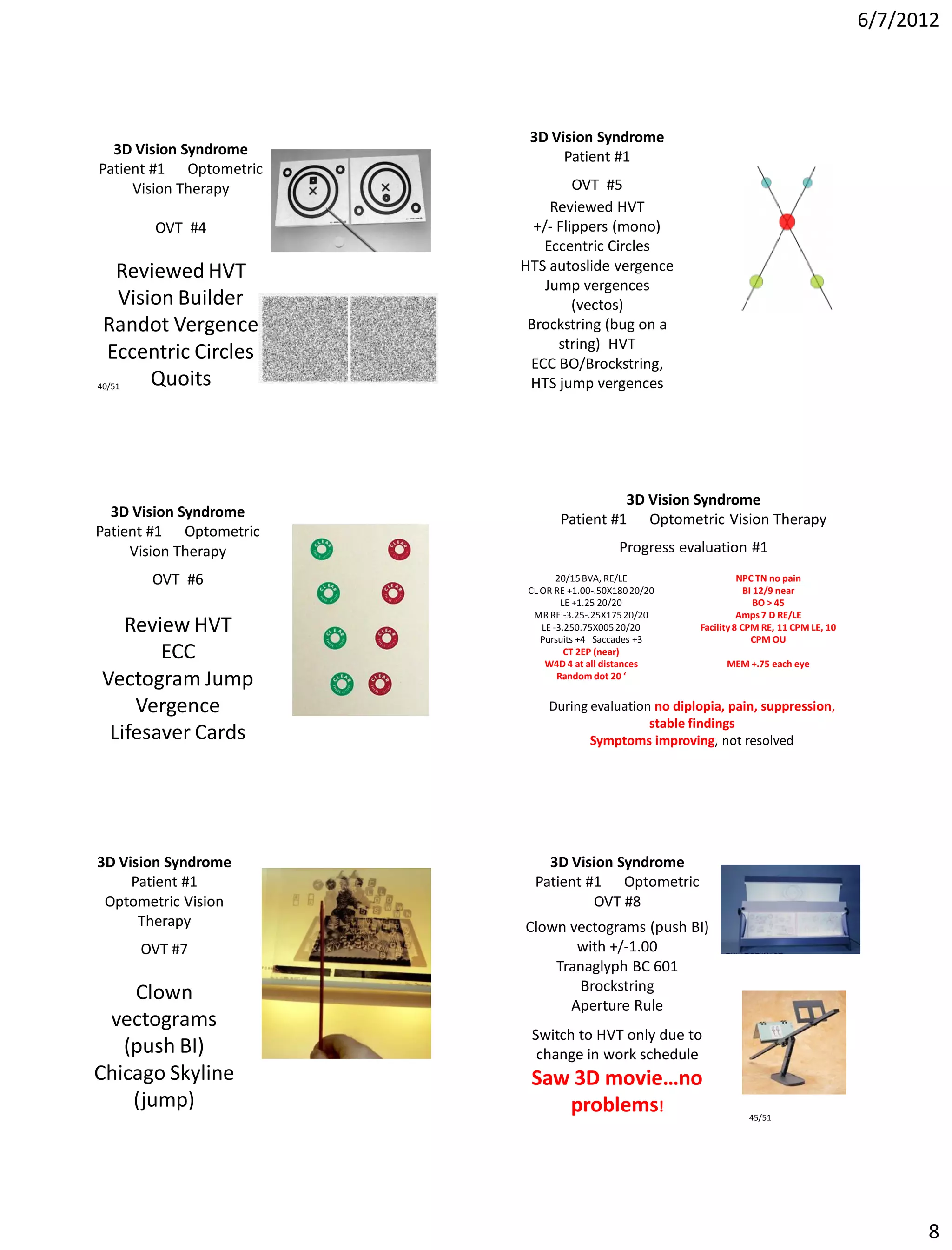 6/7/2012




                         3D Vision Syndrome
  3D Vision Syndrome          Patient #1
Patient #1 Optometric
     Vision Therapy              OVT #5
                             Reviewed HVT
       OVT #4             +/- Flippers (mono)
                           Eccentric Circles
    Reviewed HVT        HTS autoslide vergence
                            Jump vergences
     Vision Builder              (vectos)
 Randot Vergence         Brockstring (bug on a
                              string) HVT
  Eccentric Circles      ECC BO/Brockstring,
40/51    Quoits          HTS jump vergences




                                          3D Vision Syndrome
  3D Vision Syndrome            Patient #1 Optometric Vision Therapy
Patient #1 Optometric
     Vision Therapy                          Progress evaluation #1
       OVT #6                   20/15 BVA, RE/LE                   NPC TN no pain
                         CL OR RE +1.00-.50X180 20/20                BI 12/9 near
                                 LE +1.25 20/20                         BO > 45
                          MR RE -3.25-.25X175 20/20                Amps 7 D RE/LE
   Review HVT               LE -3.250.75X005 20/20
                            Pursuits +4 Saccades +3
                                                         Facility 8 CPM RE, 11 CPM LE, 10
                                                                       CPM OU
       ECC                        CT 2EP (near)
                             W4D 4 at all distances            MEM +.75 each eye
Vectogram Jump                  Random dot 20 ‘


    Vergence                 During evaluation no diplopia, pain, suppression,
                                              stable findings
 Lifesaver Cards                    Symptoms improving, not resolved




3D Vision Syndrome          3D Vision Syndrome
     Patient #1           Patient #1 Optometric
 Optometric Vision                 OVT #8
      Therapy           Clown vectograms (push BI)
     OVT #7                    with +/-1.00
                            Tranaglyph BC 601
                                Brockstring
    Clown                     Aperture Rule
 vectograms
                         Switch to HVT only due to
   (push BI)              change in work schedule
Chicago Skyline          Saw 3D movie…no
    (jump)                  problems!                               45/51




                                                                                                  8
 