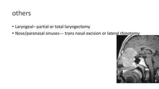 Total Rhinotomy Main paragangliomas | PPTX