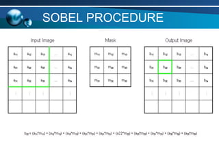 SOBEL PROCEDURE
 
