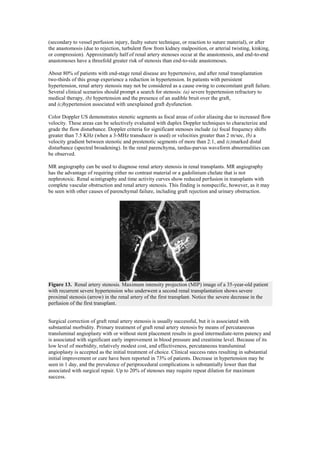 (secondary to vessel perfusion injury, faulty suture technique, or reaction to suture material), or after
the anastomosis (due to rejection, turbulent flow from kidney malposition, or arterial twisting, kinking,
or compression). Approximately half of renal artery stenoses occur at the anastomosis, and end-to-end
anastomoses have a threefold greater risk of stenosis than end-to-side anastomoses.

About 80% of patients with end-stage renal disease are hypertensive, and after renal transplantation
two-thirds of this group experience a reduction in hypertension. In patients with persistent
hypertension, renal artery stenosis may not be considered as a cause owing to concomitant graft failure.
Several clinical scenarios should prompt a search for stenosis: (a) severe hypertension refractory to
medical therapy, (b) hypertension and the presence of an audible bruit over the graft,
and (c)hypertension associated with unexplained graft dysfunction.

Color Doppler US demonstrates stenotic segments as focal areas of color aliasing due to increased flow
velocity. These areas can be selectively evaluated with duplex Doppler techniques to characterize and
grade the flow disturbance. Doppler criteria for significant stenoses include (a) focal frequency shifts
greater than 7.5 KHz (when a 3-MHz transducer is used) or velocities greater than 2 m/sec, (b) a
velocity gradient between stenotic and prestenotic segments of more than 2:1, and (c)marked distal
disturbance (spectral broadening). In the renal parenchyma, tardus-parvus waveform abnormalities can
be observed.

MR angiography can be used to diagnose renal artery stenosis in renal transplants. MR angiography
has the advantage of requiring either no contrast material or a gadolinium chelate that is not
nephrotoxic. Renal scintigraphy and time activity curves show reduced perfusion in transplants with
complete vascular obstruction and renal artery stenosis. This finding is nonspecific, however, as it may
be seen with other causes of parenchymal failure, including graft rejection and urinary obstruction.




Figure 13. Renal artery stenosis. Maximum intensity projection (MIP) image of a 35-year-old patient
with recurrent severe hypertension who underwent a second renal transplantation shows severe
proximal stenosis (arrow) in the renal artery of the first transplant. Notice the severe decrease in the
perfusion of the first transplant.


Surgical correction of graft renal artery stenosis is usually successful, but it is associated with
substantial morbidity. Primary treatment of graft renal artery stenosis by means of percutaneous
transluminal angioplasty with or without stent placement results in good intermediate-term patency and
is associated with significant early improvement in blood pressure and creatinine level. Because of its
low level of morbidity, relatively modest cost, and effectiveness, percutaneous transluminal
angioplasty is accepted as the initial treatment of choice. Clinical success rates resulting in substantial
initial improvement or cure have been reported in 73% of patients. Decrease in hypertension may be
seen in 1 day, and the prevalence of periprocedural complications is substantially lower than that
associated with surgical repair. Up to 20% of stenoses may require repeat dilation for maximum
success.
 