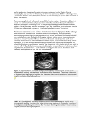 unobstructed ureter, since an unobstructed system shows clearance into the bladder. Diuretic
renography has proved useful for determining the functional significance of dilated collecting systems.
Conventional clearance times (furosemide clearance t1/2>20 minutes ) can be used in the assessment of
urinary tract patency.

Excretory urography is only infrequently successful for locating a urinary obstruction, and the site is
usually best determined with an antegrade contrast material examination. The superficial anterior
position of the allograft allows easy access for antegrade pyelography performed with real-time US
guidance. The Whitaker test is helpful in equivocal cases. The combination of normal results from the
Whitaker test and antegrade pyelography virtually excludes the presence of obstruction.

Percutaneous nephrostomy is used to relieve obstruction and allow the deployment of other radiologic
interventions such as ureteral stent placement and balloon ureteroplasty. Balloon dilation of
posttransplantation ureteral strictures produces an overall success rate of ureteral dilatation in 90% of
cases, with the best results obtained in fresh surgical strictures and the poorest in chronic ischemic
strictures or areas of periureteral fibrosis. Strictures of the middle and upper ureters result most
commonly from ischemic or periureteral fibrosis and may require surgical intervention. High balloon
pressures of 10–12 atm or greater are usually needed for successful dilation, and the balloon is left
inflated for 20 minutes or until balloon ―waisting‖ has disappeared. After dilation, a 10-F stent is left in
place for only 10 days. In the immunocompromised transplant recipient, the risk of infection precludes
long-term stent placement unless a totally internal, double pigtail stent is used. Recurrences most
commonly develop within the first year after transplantation.




Figure 3a. Hydronephrosis relieved by stent placement.(a) Gray-scale sonogram reveals severe
hydronephrosis resulting from narrowing at the ureterovesical anastomosis. Obstruction was relieved
by stent placement. (b)Sonogram obtained after placement of a retrograde stent (arrow) demonstrates
complete resolution of the hydronephrosis.




Figure 3b. Hydronephrosis relieved by stent placement.(a) Gray-scale sonogram reveals severe
hydronephrosis resulting from narrowing at the ureterovesical anastomosis. Obstruction was relieved
by stent placement. (b)Sonogram obtained after placement of a retrograde stent (arrow) demonstrates
complete resolution of the hydronephrosis.
 