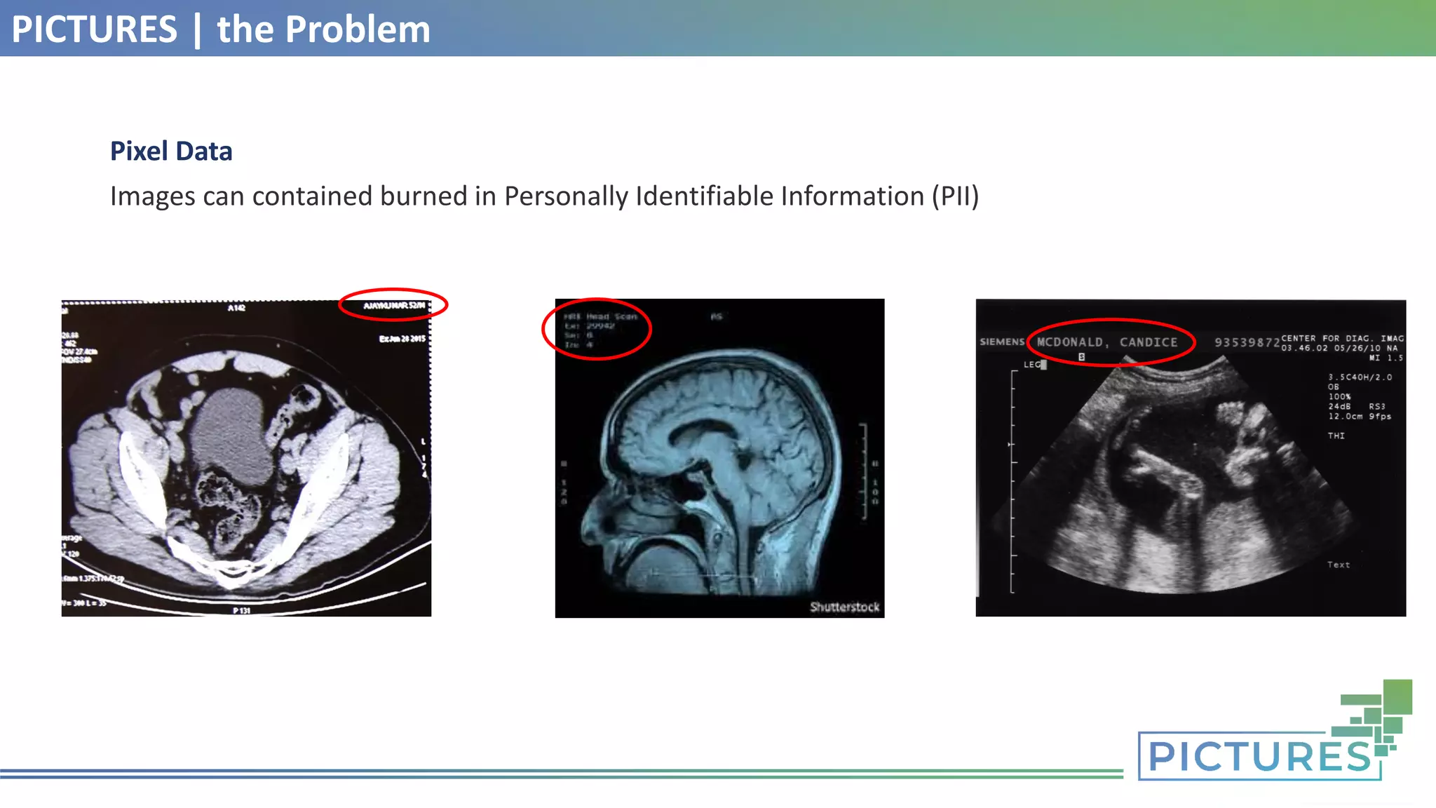 PICTURES | the Problem
Pixel Data
Images can contained burned in Personally Identifiable Information (PII)
 