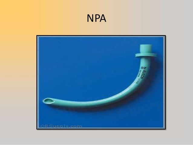 Maintaining patent airway