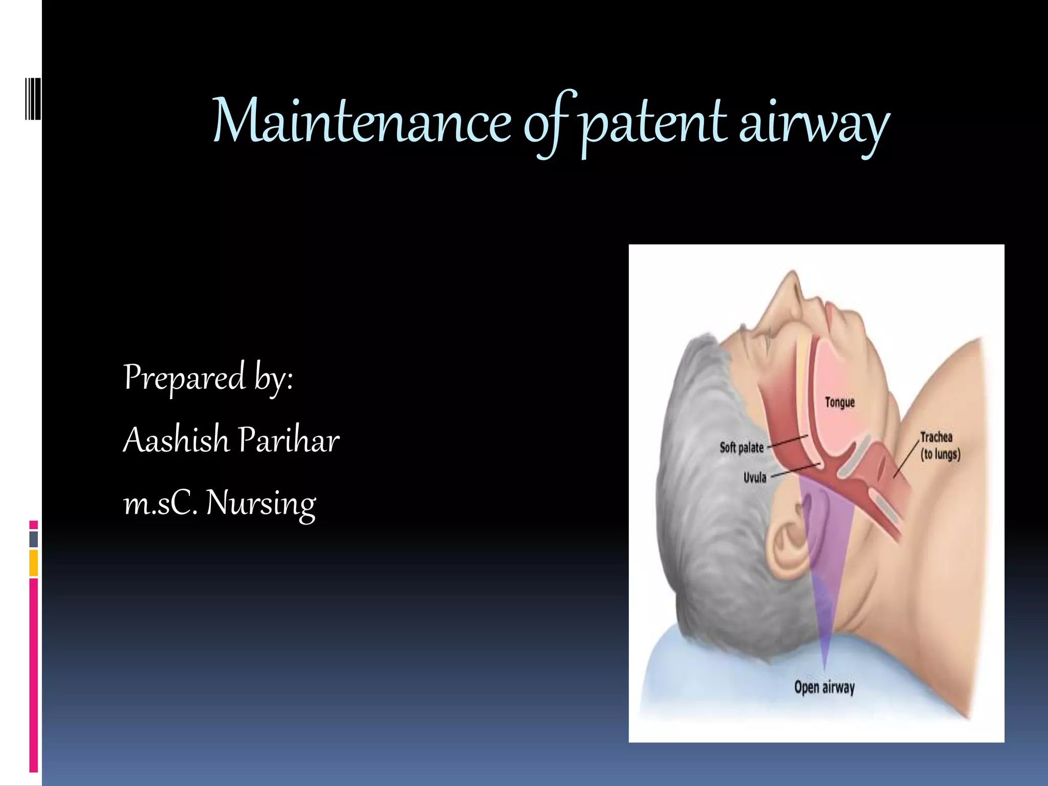 Is Your Airway Patent? Find Out Now! - 234x037