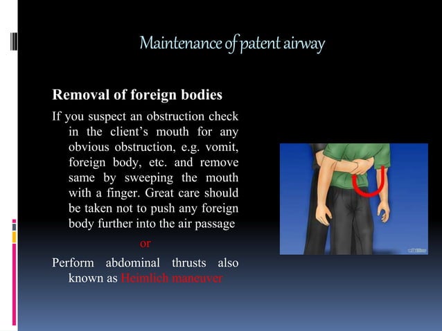 Maintenace of patent airway | PPT