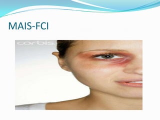 MAIS-FCI
 