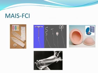 MAIS-FCI
 