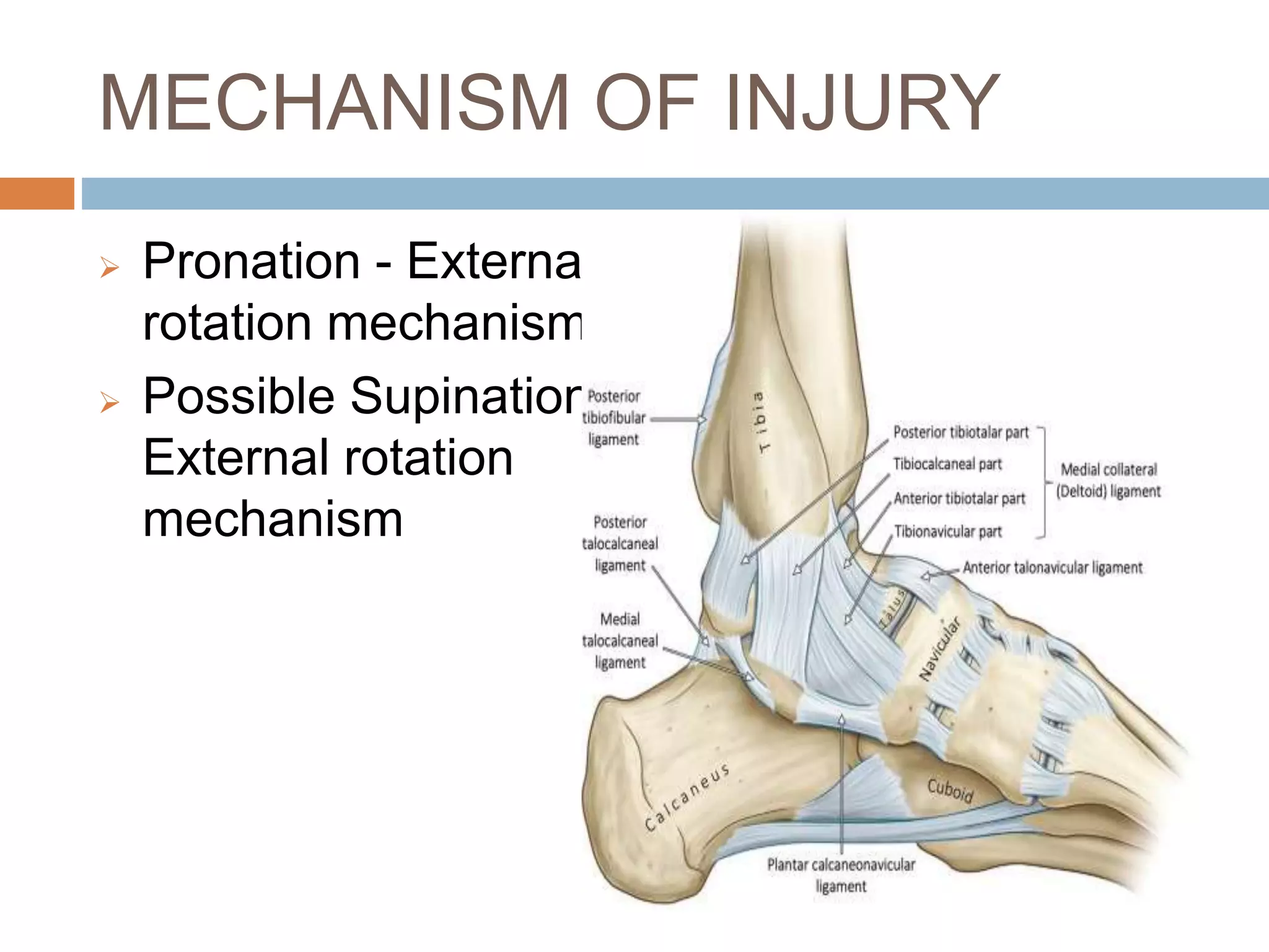 MAISONNEUVE FRACTURE OF ANKLE JOINT | PPTX