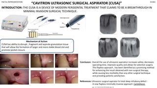 “CAVITRON ULTRASONIC SURGICAL ASPIRATOR (CUSA)”
FACTUL REPRESENTATION ID-841
INTRODUCTION :THE CUSA IS A DEVICE OF MODERN PERIDONTAL TREATMENT THAT CLAIMS TO BE A BREAKTHROUGH IN
MINIMAL INVASION SURGICAL TECHNIQUE.
Mechanism of Action
CUSA has ability to disrupt , fragment and aspirate granulation tissue
that will allow the formation of larger and more stable blood clot and
promote pocket closure.
Conclusion: Overall the use of ultrasonic aspiration increases safety, decreases
operating time, improves quality and allows for selective surgery.
This flapless approach , has been identified as a promising method
for enhancing the result obtained with non-surgical therapy,
while causing less morbidity than any other surgical technique
and providing patients satisfaction.
References: Ultrasonic surgical aspirator to treat deep infrabony defect :
A new flapless minimally invasive approach CarloGhezzi,
 