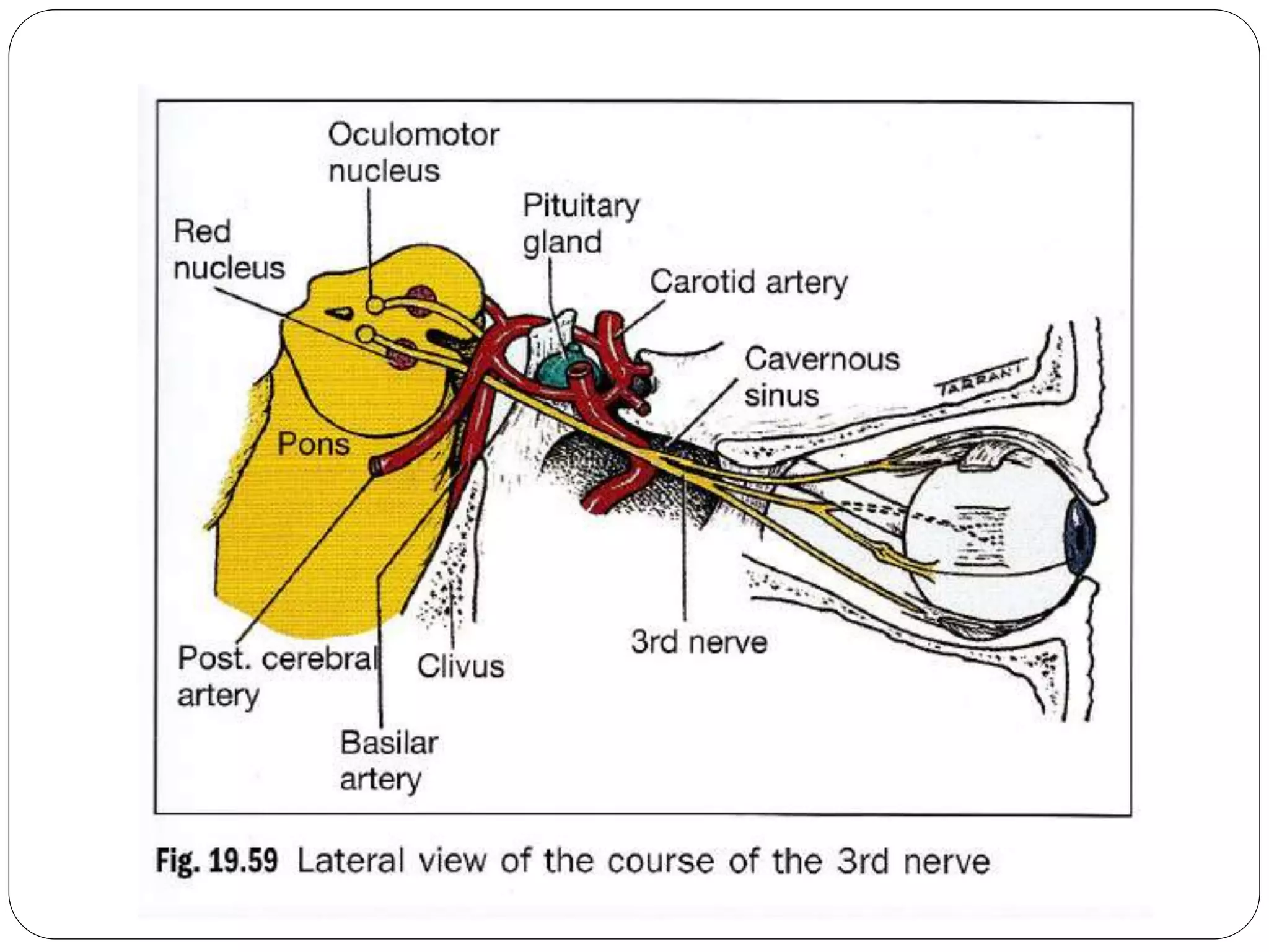 3rd nerve palsy | PPTX