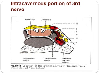 Intracavernous portion of 3rd
nerve
 