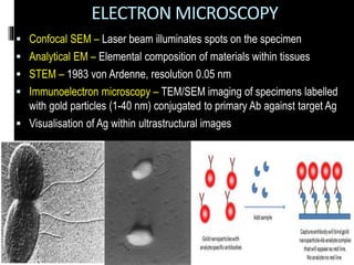 ELECTRON MICROSCOPY
 Confocal SEM – Laser beam illuminates spots on the specimen
 Analytical EM – Elemental composition of materials within tissues
 STEM – 1983 von Ardenne, resolution 0.05 nm
 Immunoelectron microscopy – TEM/SEM imaging of specimens labelled
with gold particles (1-40 nm) conjugated to primary Ab against target Ag
 Visualisation of Ag within ultrastructural images
 