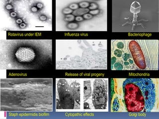 Rotavirus under IEM Influenza virus Bacteriophage
Adenovirus Release of viral progeny Mitochondria
Staph epidermidis biofilm Cytopathic effects Golgi body
 