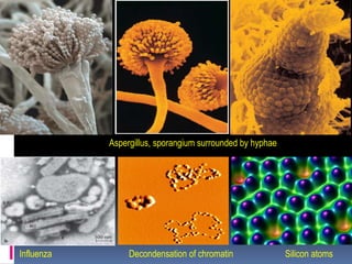 Aspergillus, sporangium surrounded by hyphae
Influenza Decondensation of chromatin Silicon atoms
 