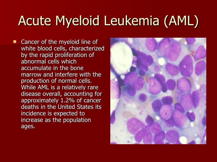 what is the rarest form of leukemia major depressive symptoms associated with acute myeloid what is the rarest form of leukemia major depressive symptoms associated with acute myeloid