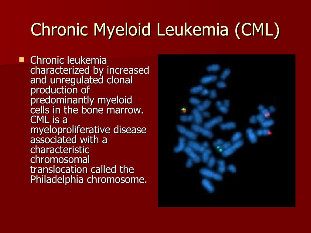 Major Depressive Symptoms Associated with Acute Myeloid