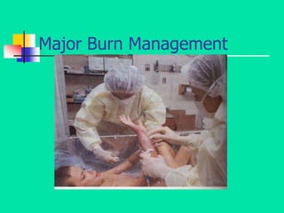 Major Burn Management
 