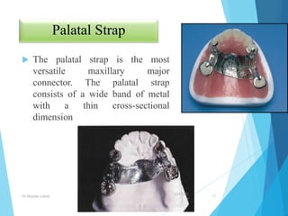 Palatable Strap Rpd Major connector In prosthodontics | PPTX