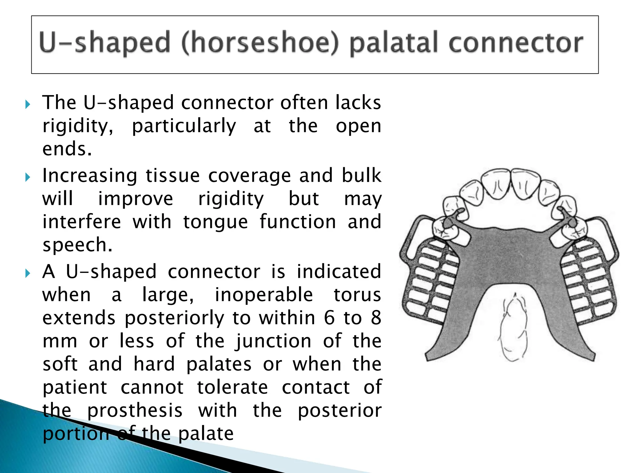 Major connector removable partial denture | PPTX | Dental Health ...