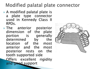 Major connector removable partial denture | PPTX