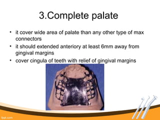 3.Complete palate
• it cover wide area of palate than any other type of max
connectors
• it should extended anteriory at least 6mm away from
gingival margins
• cover cingula of teeth with relief of gingival margins
 
