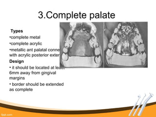 3.Complete palate
Types
•complete metal
•complete acrylic
•metallic ant palatal connector
with acrylic posterior extension
Design
• it should be located at least
6mm away from gingival
margins
• border should be extended
as complete
 