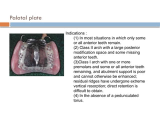 MAJOR connectors.pptx of removable partial denture | PPTX