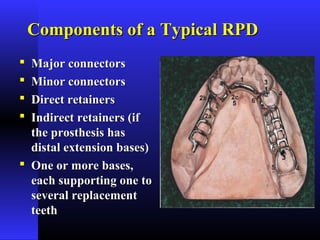 Components of a Typical RPDComponents of a Typical RPD
 Major connectorsMajor connectors
 Minor connectorsMinor connectors
 Direct retainersDirect retainers
 Indirect retainers (ifIndirect retainers (if
the prosthesis hasthe prosthesis has
distal extension bases)distal extension bases)
 One or more bases,One or more bases,
each supporting one toeach supporting one to
several replacementseveral replacement
teethteeth
 