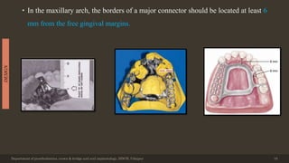 • In the maxillary arch, the borders of a major connector should be located at least 6
mm from the free gingival margins.
Department of prosthodontics, crown & bridge and oral implantology, DDCH, Udaipur 10
DESIGN
 
